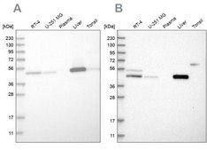 Anti-PCYT2 antibody produced in rabbit Prestige Antibodies® Powered by Atlas Antibodies, affinity isolated antibody, buffered aqueous glycerol solution, Ab2