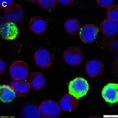 Anti-RSV type A Antibody, B Antibody, clone 133-1H ZooMAb® Mouse Monoclonal recombinant, expressed in HEK 293 cells