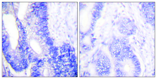 Anti-Claudin 3 antibody produced in rabbit affinity isolated antibody