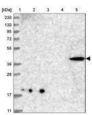 Anti-CNTLN antibody produced in rabbit Prestige Antibodies® Powered by Atlas Antibodies, affinity isolated antibody, buffered aqueous glycerol solution