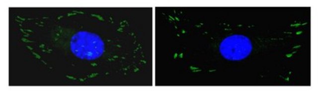 Anti-FAK Antibody, clone 4.47, Alexa Fluor&#8482; 488 conjugate clone 4.47, Upstate&#174;, from mouse