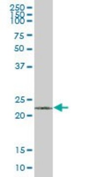 Anti-VHL antibody produced in mouse purified immunoglobulin, buffered aqueous solution