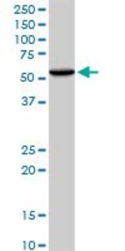 Anti-WARS antibody produced in mouse purified immunoglobulin, buffered aqueous solution