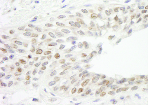 Rabbit anti-ATRIP Antibody, Affinity Purified Powered by Bethyl Laboratories, Inc.