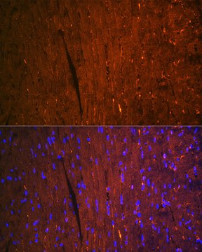 Anti-FABP3 Antibody, clone 9B9D7, Rabbit Monoclonal