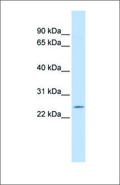 Anti-PSMB5 antibody produced in rabbit affinity isolated antibody