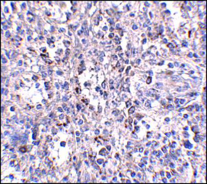 Anti-SCARB1 antibody produced in rabbit affinity isolated antibody, buffered aqueous solution