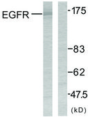 Anti-EGFR antibody produced in rabbit affinity isolated antibody
