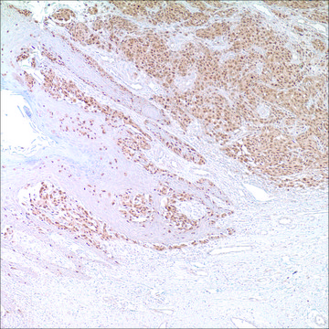 Microphthalmia Transcription Factor (MiTF) (C5/D5) Mouse Monoclonal Antibody