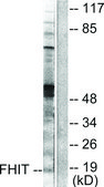 Anti-FHIT antibody produced in rabbit affinity isolated antibody