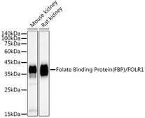 Anti-Folate Binding Protein(FBP) / FOLR1 Antibody, clone 3J6W3, Rabbit Monoclonal