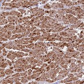 Anti-NDUFA8 antibody produced in rabbit Prestige Antibodies® Powered by Atlas Antibodies, affinity isolated antibody, buffered aqueous glycerol solution