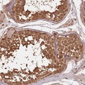 Anti-UBE3A antibody produced in rabbit Prestige Antibodies® Powered by Atlas Antibodies, affinity isolated antibody, buffered aqueous glycerol solution