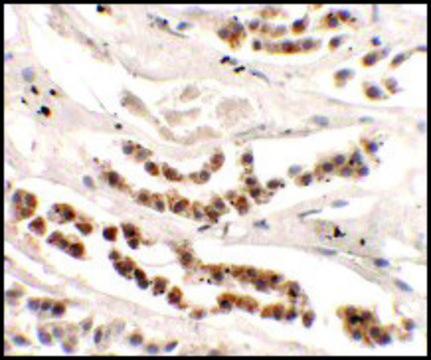 Anti-DISP1 antibody produced in rabbit affinity isolated antibody