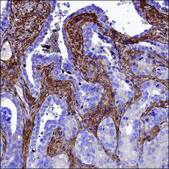 Anti-LOXL1 antibody produced in rabbit Prestige Antibodies® Powered by Atlas Antibodies, affinity isolated antibody, buffered aqueous glycerol solution