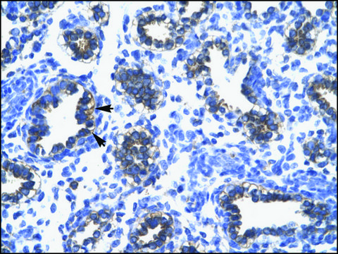 Anti-RPS16 (AB1) antibody produced in rabbit IgG fraction of antiserum