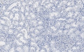 Anti-ULK2 Antibody, clone 3E19 ZooMAb® Rabbit Monoclonal recombinant, expressed in HEK 293 cells
