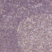 Anti-CNTRL antibody produced in rabbit Prestige Antibodies® Powered by Atlas Antibodies, affinity isolated antibody, buffered aqueous glycerol solution
