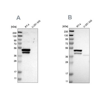 Anti-KRT23 antibody produced in rabbit Prestige Antibodies&#174; Powered by Atlas Antibodies, affinity isolated antibody, buffered aqueous glycerol solution