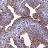 Anti-B9D2 antibody produced in rabbit Prestige Antibodies® Powered by Atlas Antibodies, affinity isolated antibody, buffered aqueous glycerol solution