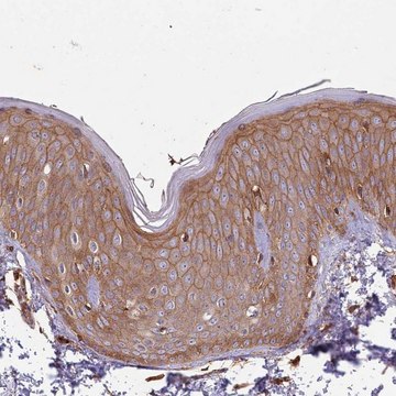 Anti-ACVR2A antibody produced in rabbit Prestige Antibodies&#174; Powered by Atlas Antibodies, affinity isolated antibody, buffered aqueous glycerol solution