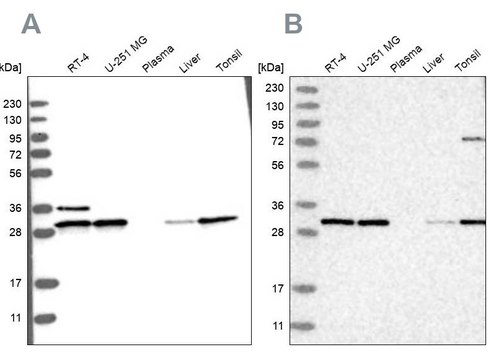 Anti-RPA2 antibody produced in rabbit Prestige Antibodies&#174; Powered by Atlas Antibodies, affinity isolated antibody, buffered aqueous glycerol solution, ab1