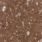 Anti-CPNE5 antibody produced in rabbit Prestige Antibodies® Powered by Atlas Antibodies, affinity isolated antibody, buffered aqueous glycerol solution