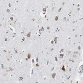 Anti-RPL35 antibody produced in rabbit Prestige Antibodies® Powered by Atlas Antibodies, affinity isolated antibody, buffered aqueous glycerol solution
