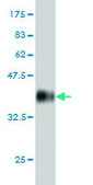 Monoclonal Anti-DKFZp761P0423 antibody produced in mouse clone 5C6, purified immunoglobulin, buffered aqueous solution