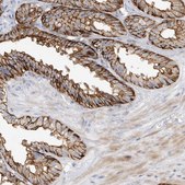 Anti-TPCN2 antibody produced in rabbit Prestige Antibodies® Powered by Atlas Antibodies, affinity isolated antibody, buffered aqueous glycerol solution