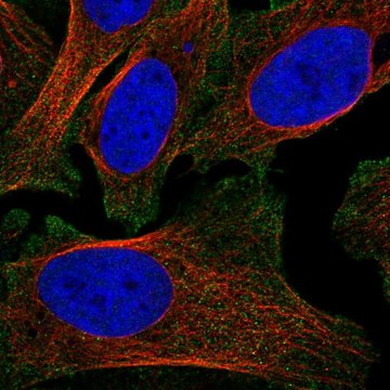 Anti-Sdc2 Antibody Produced In Rabbit Prestige Antibodies&#174; Powered by Atlas Antibodies, affinity isolated antibody, buffered aqueous glycerol solution