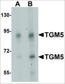 Anti-TGM5 antibody produced in rabbit affinity isolated antibody