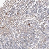 Anti-MTFR2 antibody produced in rabbit Prestige Antibodies® Powered by Atlas Antibodies, affinity isolated antibody, buffered aqueous glycerol solution, ab1