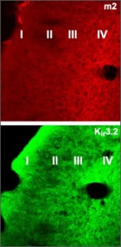 Anti-Muscarinic Acetylcholine Receptor (M2) antibody produced in rabbit affinity isolated antibody