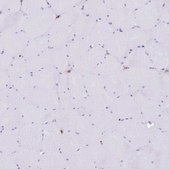 Anti-EFHD2 antibody produced in rabbit Prestige Antibodies® Powered by Atlas Antibodies, affinity isolated antibody, buffered aqueous glycerol solution