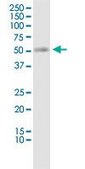 Monoclonal Anti-SLC19A2 antibody produced in mouse clone 5B10, purified immunoglobulin, buffered aqueous solution