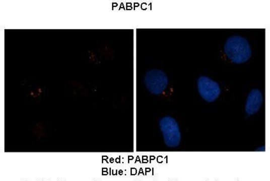 Anti-PABPC1 affinity isolated antibody