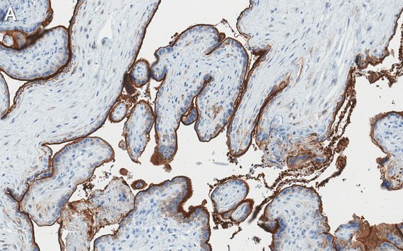 Anti-Integrin &#946;3 Antibody, clone EM00212 ZooMAb&#174; Rabbit Monoclonal recombinant, expressed in HEK 293 cells