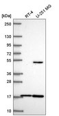 Anti-RNF13 antibody produced in rabbit Prestige Antibodies® Powered by Atlas Antibodies, affinity isolated antibody