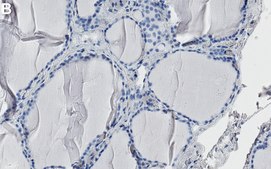 Anti-Cyclophilin B Antibody, clone 4D5 ZooMAb® Rabbit Monoclonal recombinant, expressed in HEK 293 cells