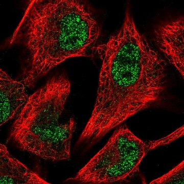 Anti-PFKFB3 antibody produced in rabbit Prestige Antibodies&#174; Powered by Atlas Antibodies, affinity isolated antibody