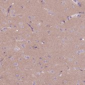 Anti-RFX4 antibody produced in rabbit Prestige Antibodies® Powered by Atlas Antibodies, affinity isolated antibody, buffered aqueous glycerol solution