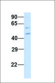 Anti-ZBTB7A antibody produced in rabbit affinity isolated antibody