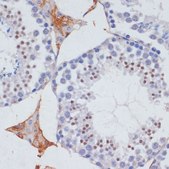 Anti-SKIV2L2 antibody produced in rabbit