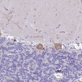 Anti-MTSS1L antibody produced in rabbit Prestige Antibodies® Powered by Atlas Antibodies, affinity isolated antibody, buffered aqueous glycerol solution