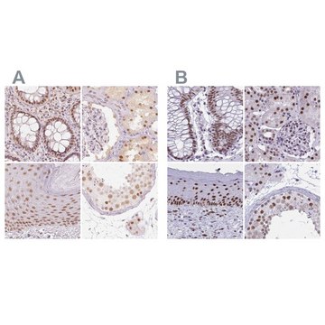 Anti-PPP1R10 antibody produced in rabbit Prestige Antibodies&#174; Powered by Atlas Antibodies, affinity isolated antibody, buffered aqueous glycerol solution