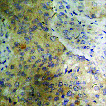 Anti-phospho-PLB (pSer16+Thr17) antibody produced in rabbit affinity isolated antibody