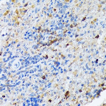 Anti-CARD11 antibody produced in rabbit