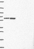 Anti-TOR1AIP1 antibody produced in rabbit Prestige Antibodies® Powered by Atlas Antibodies, affinity isolated antibody, buffered aqueous glycerol solution