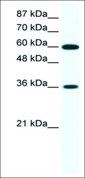 Anti-FOXF1 (AB1) antibody produced in rabbit IgG fraction of antiserum